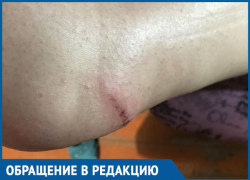 Возвращаясь вечером домой по Пламя Революции, чуть не сломала ногу, - морозовчанка Возвращаясь вечером домой по Пламя Революции, чуть не сломала ногу, - морозовчанка