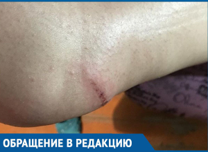 Возвращаясь вечером домой по Пламя Революции, чуть не сломала ногу, - морозовчанка Возвращаясь вечером домой по Пламя Революции, чуть не сломала ногу, - морозовчанка