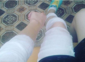 В Морозовске девушка провалилась в яму в асфальте В Морозовске девушка провалилась в яму в асфальте