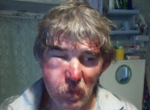 Мужчину избили в Морозовске после парковки автомобиля у частного двора Мужчину избили в Морозовске после парковки автомобиля у частного двора